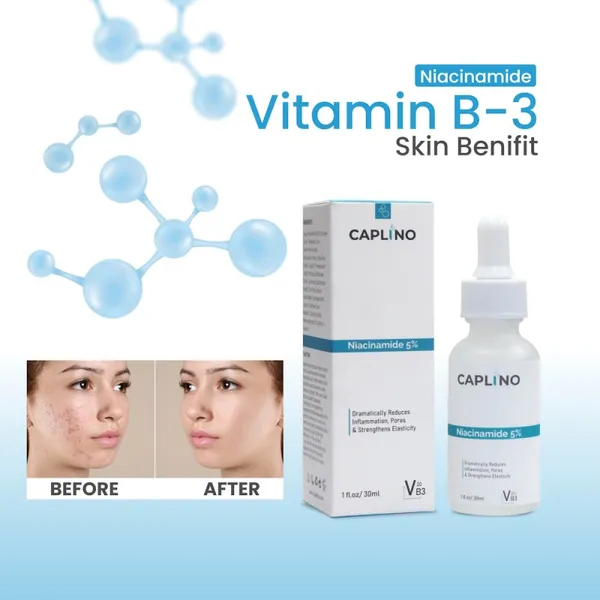 CAPLINO Niacinamide Serum 5% Vitamin B3 20% & Zinc PCA - 30ml